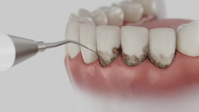 Trusted Invisalign Clear Aligners service in Connell, WA - Dentist Open Now